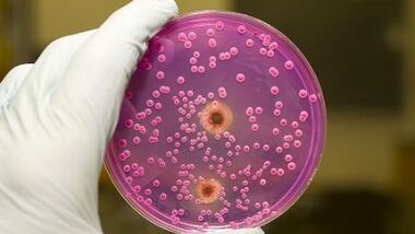 Descarga patológica em homens quando excitados